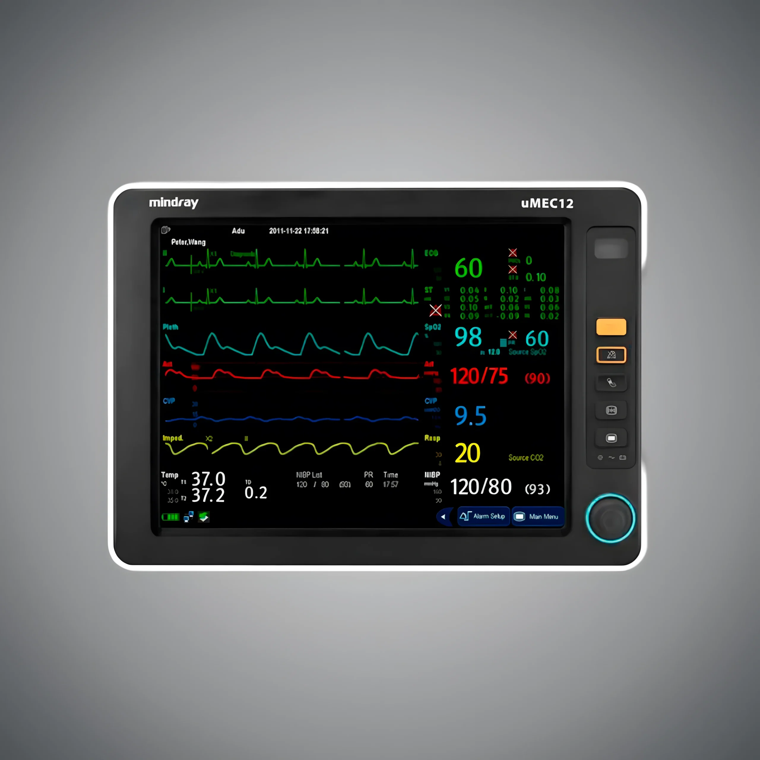 Mindray UMEC12